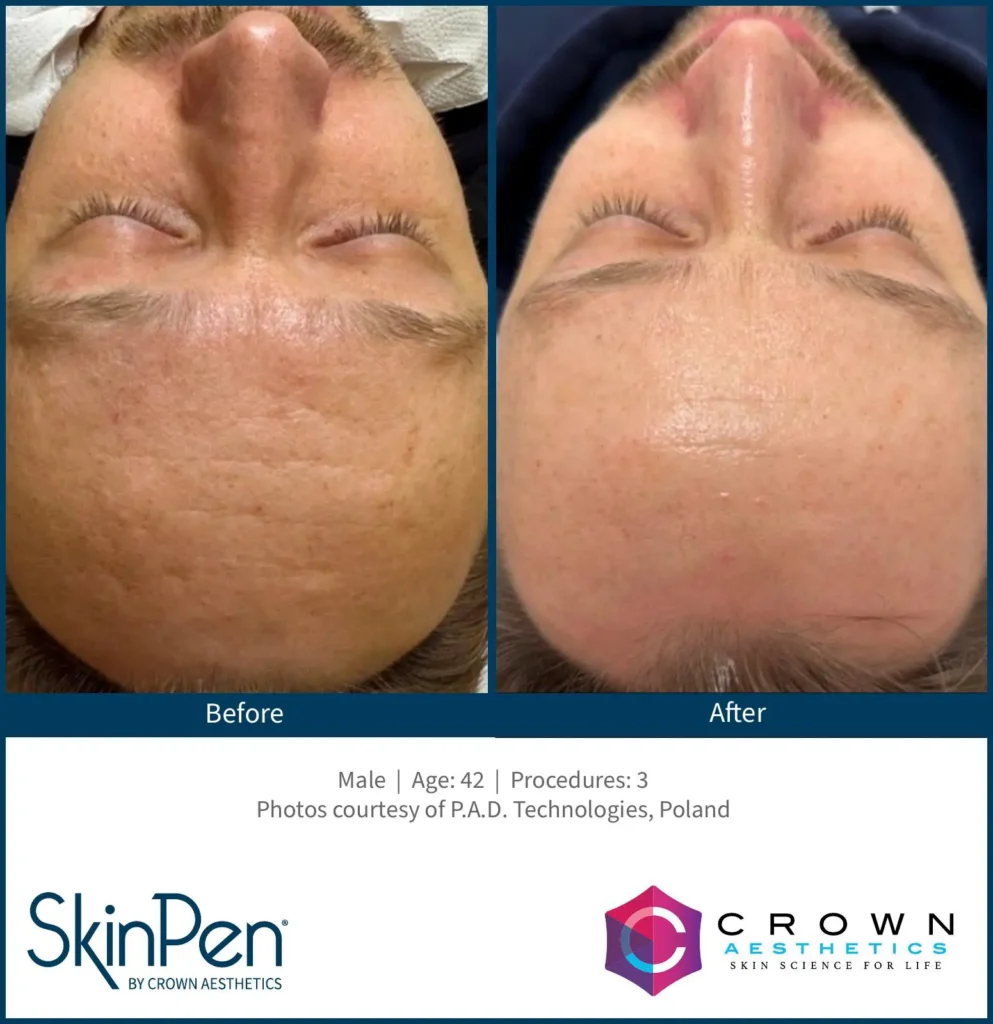 SP_BA_Dominika_Salink_Poland_Patient Feine Linien_preview